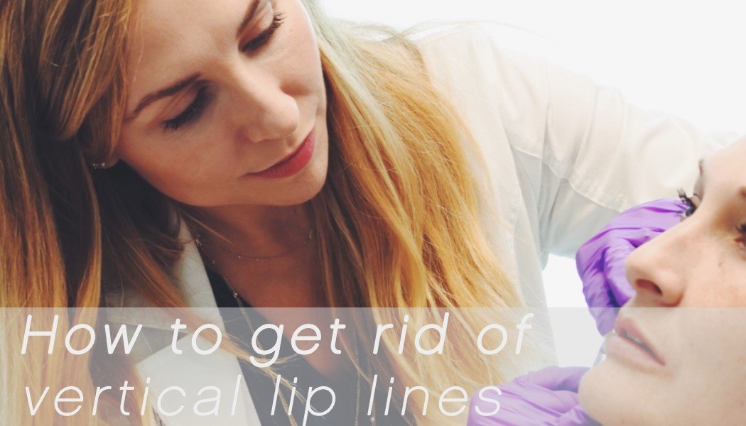 https://www.skinbylovely.com/wp-content/uploads/2017/11/how-to-get-rid-of-vertical-lip-lines.jpeg